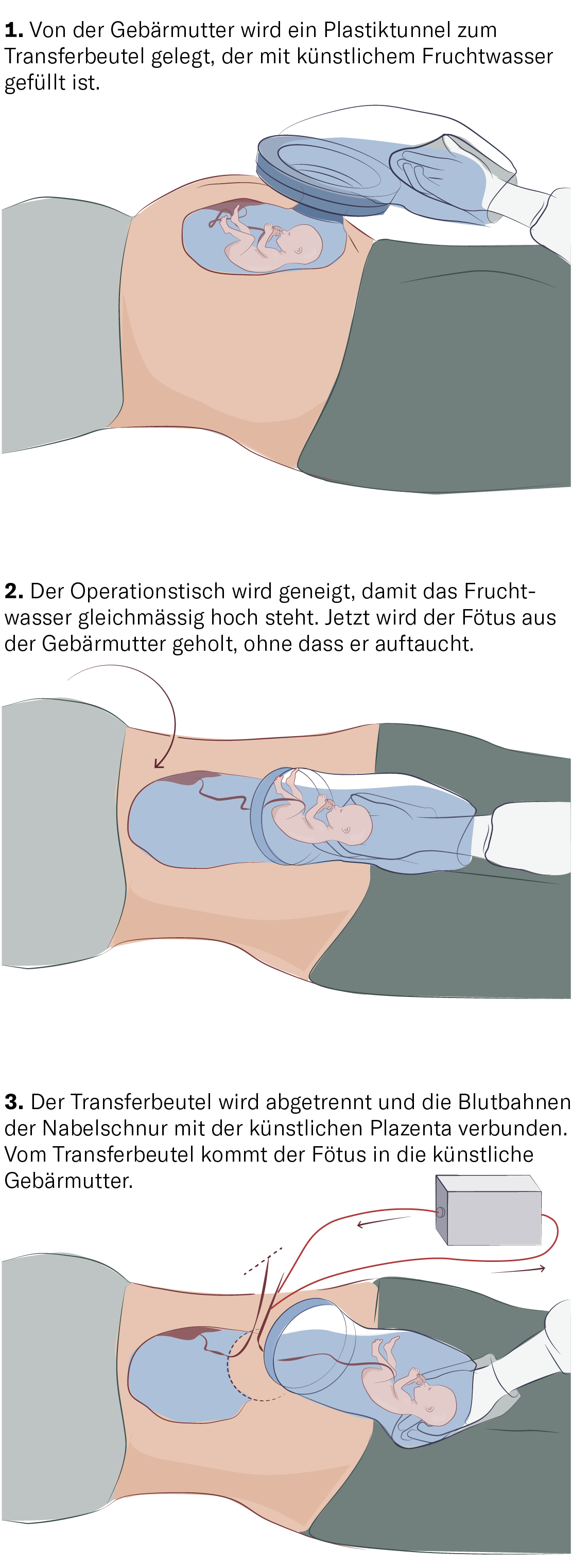 Knstliche Gebrmutter: Wie werden Menschen in Zukunft geboren?