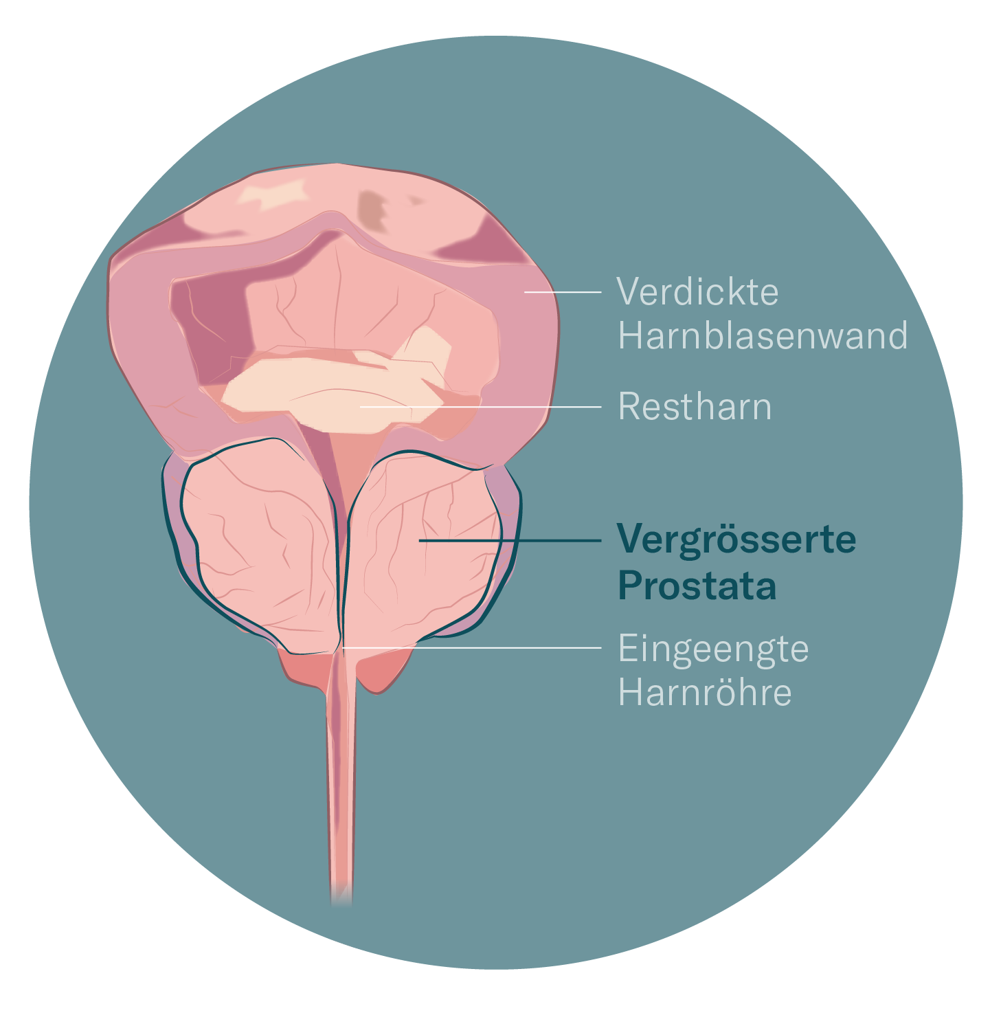Prostata: Welche Funktion das mnnliche Fortpflanzungsorgan hat
